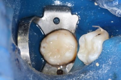 Img 0891 rlai6o - Eugenol