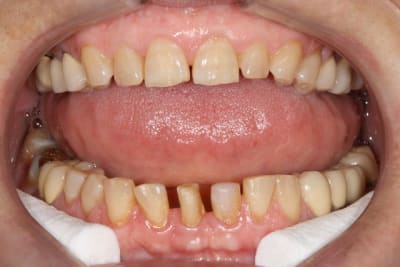 Img 0986 fwwlvd - Eugenol