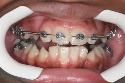 Img 0 joxkj2 - Eugenol