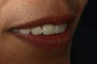 Img 1059 vanpnk - Eugenol