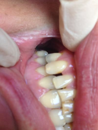 Img 1063 ntmcsm - Eugenol