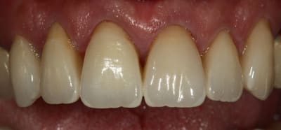 Img 1063 ygzmha - Eugenol