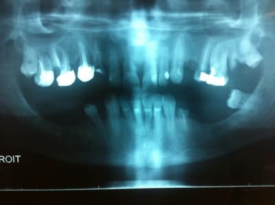 Img 1151 m5uhub - Eugenol