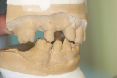 Img 1274 tjsy4i - Eugenol