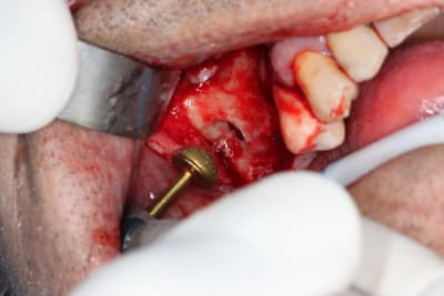 Img 1287 hqh2hs - Eugenol