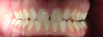 Img 1361 eamyh3 - Eugenol