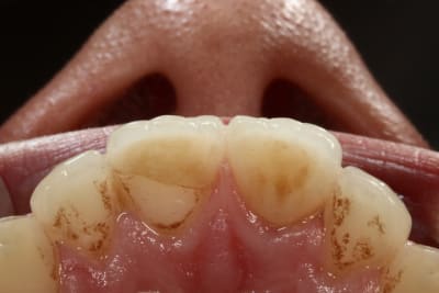 Img 1383 zhdkvn - Eugenol