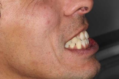 Img 1516 t0z0qg - Eugenol