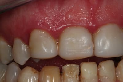 Img 1525 xwlozf - Eugenol