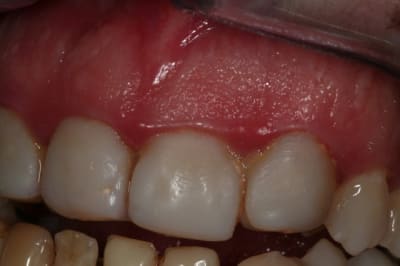 Img 1526 n4mz4z - Eugenol