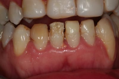 Img 1527 sj3tlo - Eugenol