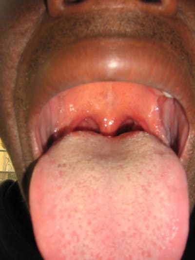 Img 1548 ogqazx - Eugenol