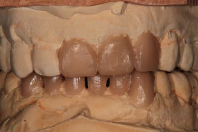 Img 1588 ytsp9p - Eugenol