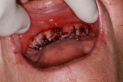 Img 1681 egagvs - Eugenol