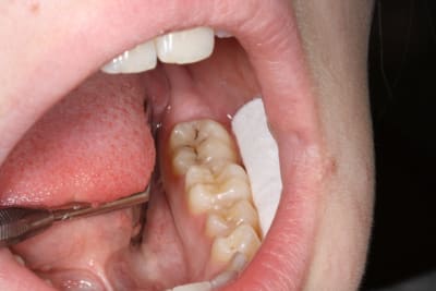 Img 1705 ezsfao - Eugenol