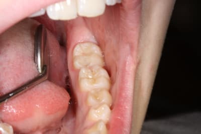 Img 1713 yoybha - Eugenol