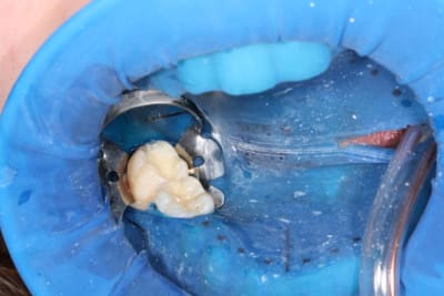 Img 1746 nrrefa - Eugenol