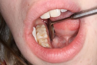 Img 1749 vxfb42 - Eugenol