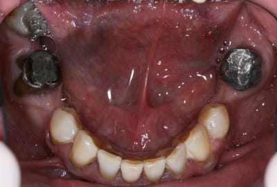 Img 1802 i6xahw - Eugenol