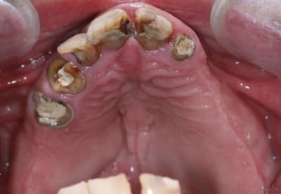 Img 1804 ic3dii - Eugenol