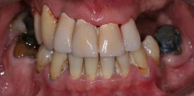 Img 1805 cxjyzm - Eugenol