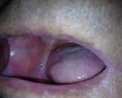 Img 1837 zqobfg - Eugenol