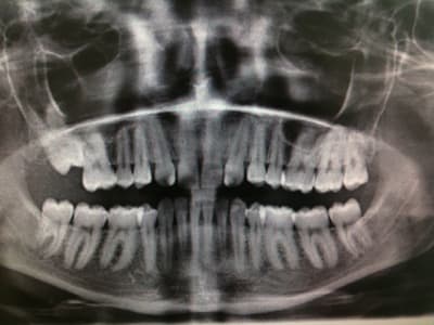 Img 1853 1  qgyupr - Eugenol