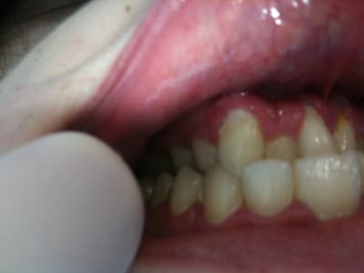 Img 1856 1  hiishm - Eugenol