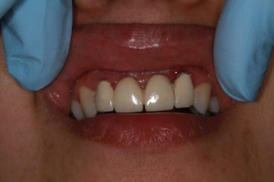 Img 1857 ivlm6h - Eugenol