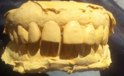 Img 1964 uygi9n - Eugenol