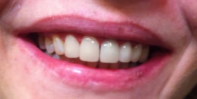 Img 1974 dpjlzc - Eugenol