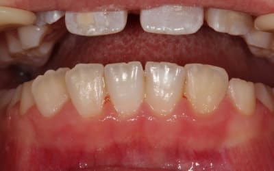 Img 1974 iumsr5 - Eugenol