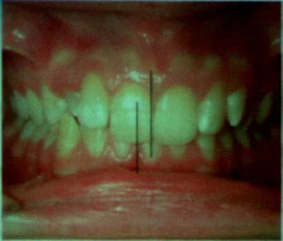 Img 1 epgwei - Eugenol