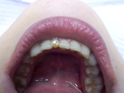 Img 20151207 185316 upwzoo - Eugenol