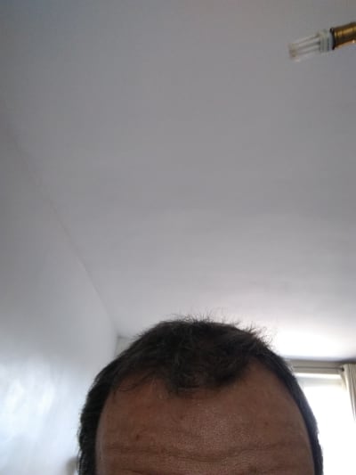 Img 20200913 113308 sxtp6o - Eugenol