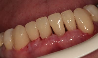 Img 2025w i9ivzt - Eugenol