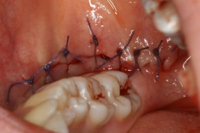 Img 2075 oguubn - Eugenol