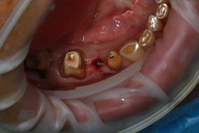 Img 2113 qrpbwu - Eugenol