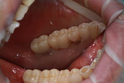 Img 2120 prcrab - Eugenol