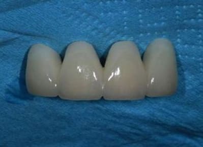 Img 2180 kqyhqr - Eugenol