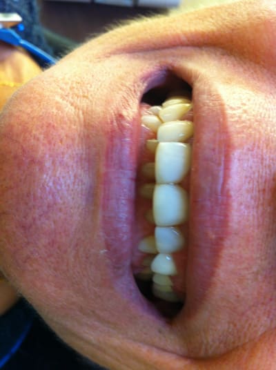 Img 2227 lqmwgf - Eugenol