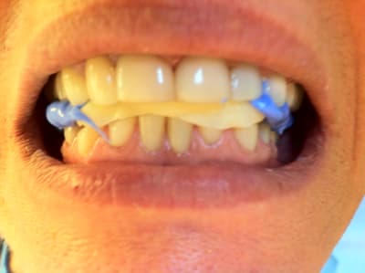 Img 2234 yzobhe - Eugenol