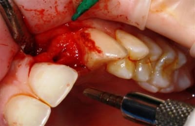 Img 2238 sap396 - Eugenol