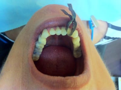 Img 2246 jcnzcm - Eugenol