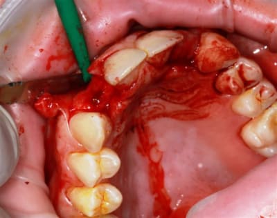 Img 2249 mtrogi - Eugenol