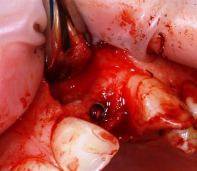 Img 2255 hecx0g - Eugenol