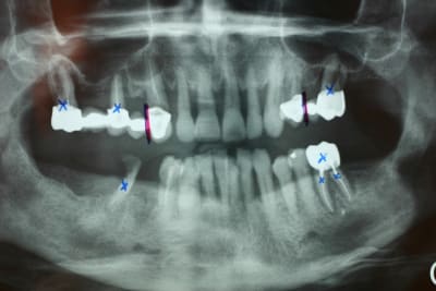 Img 2287 jjvxuw - Eugenol