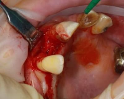 Img 2349 vwvlb0 - Eugenol