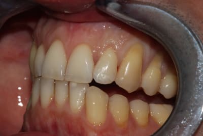 Img 2382 xuyfe8 - Eugenol