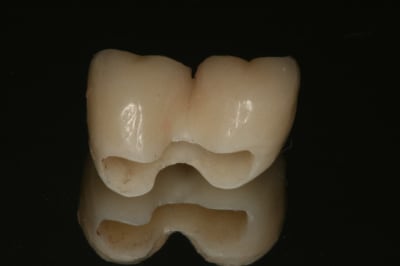 Img 2394 qc6heh - Eugenol